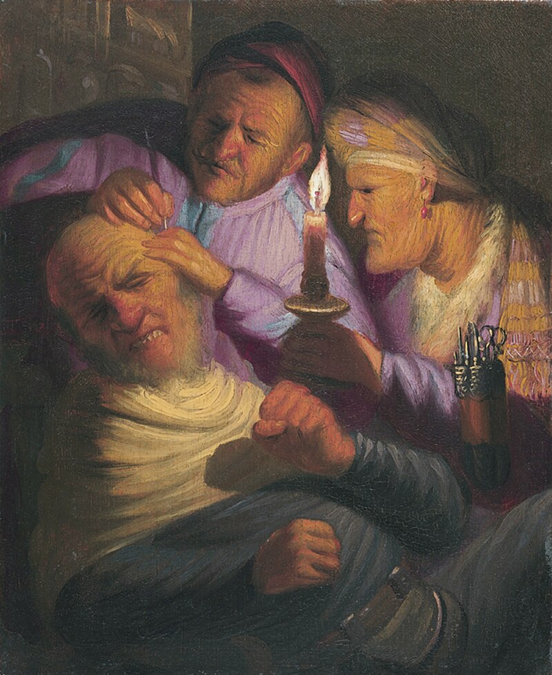 The Operation (Touch) By Rembrandt - C. 1624